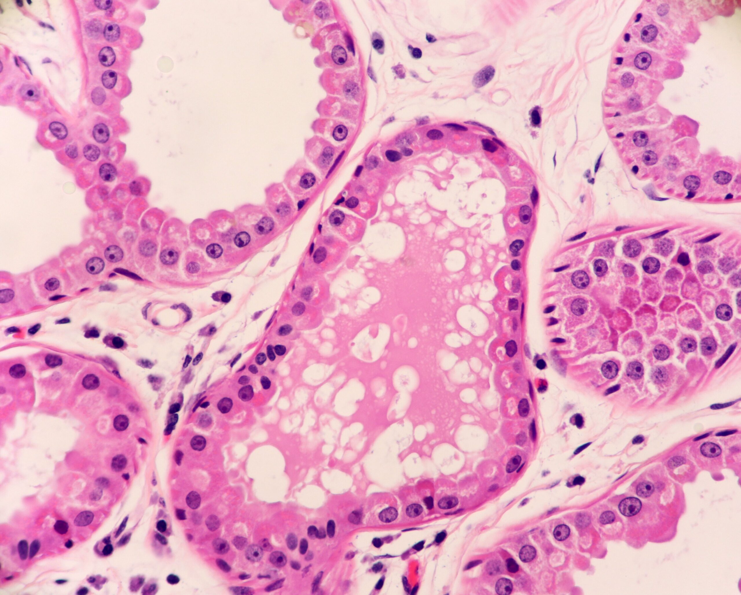 Apocrine Glands With Secretions