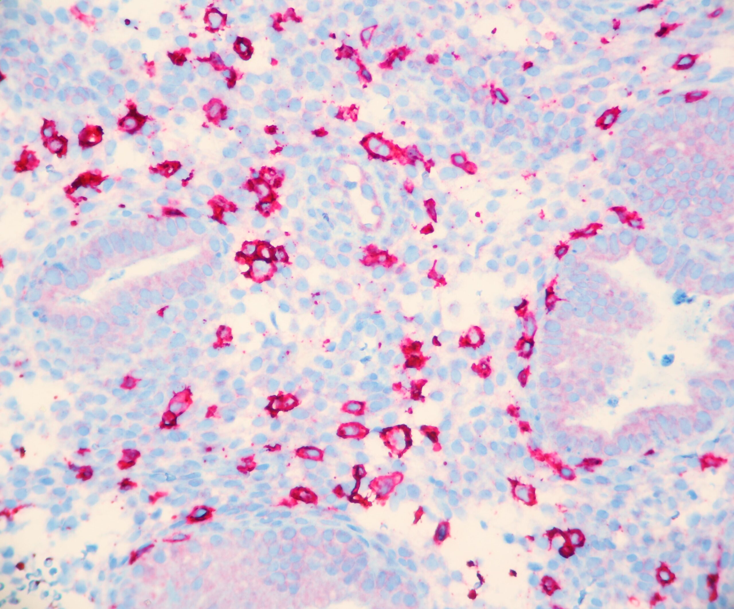 CD56 positive Natural Killer Cells in the Endometrium