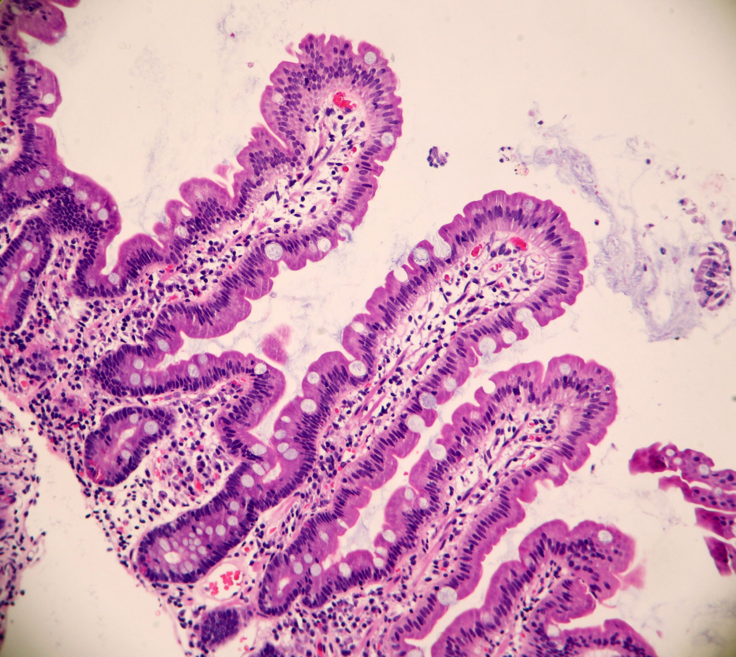 Normal Duodenum Mucosa