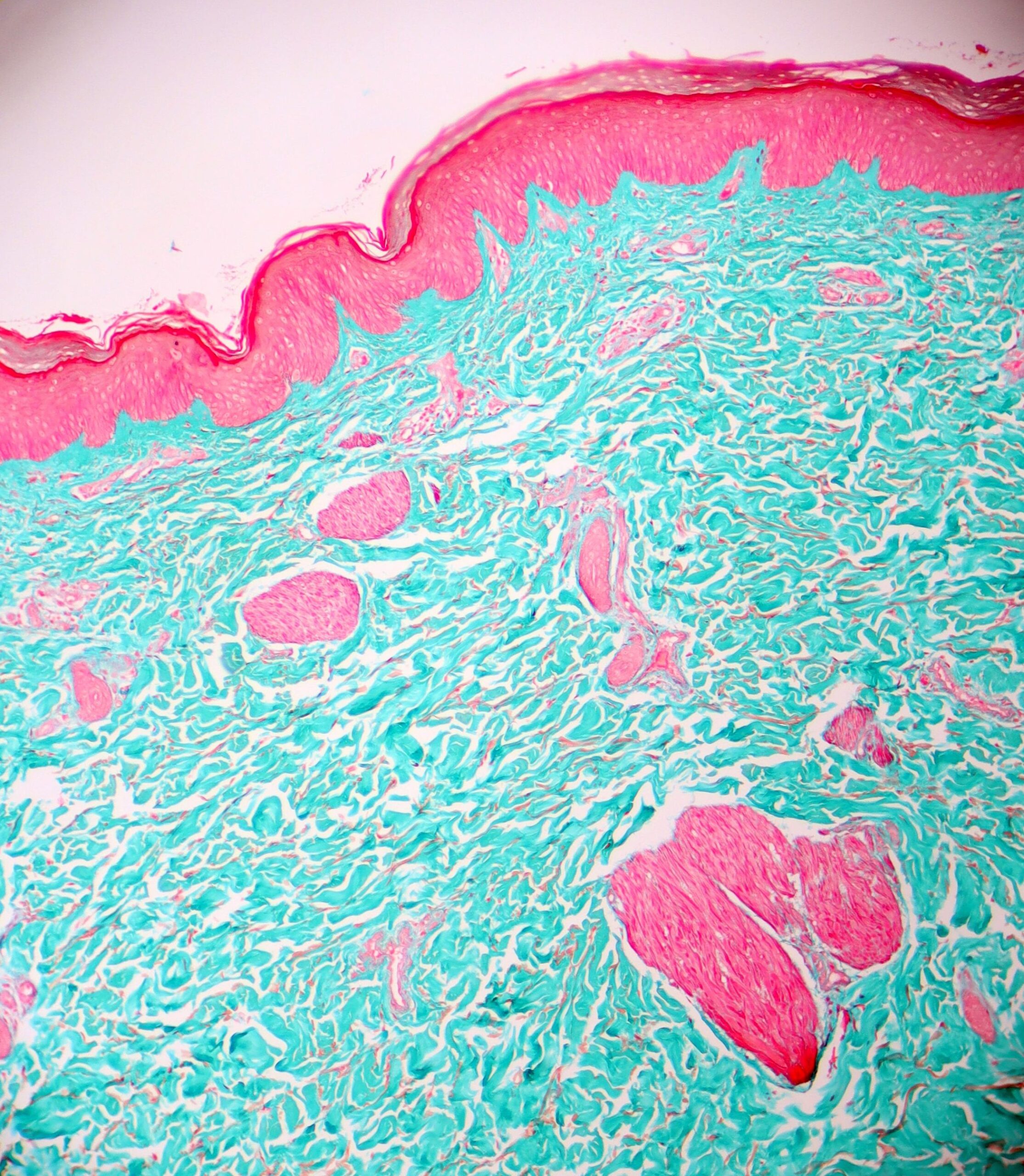 Skin, Masson Stain